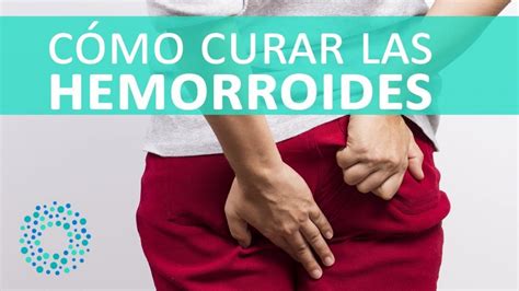 hemorroides externas fotos y videos|Hemorroides externas e internas: qué son y tratamientos 